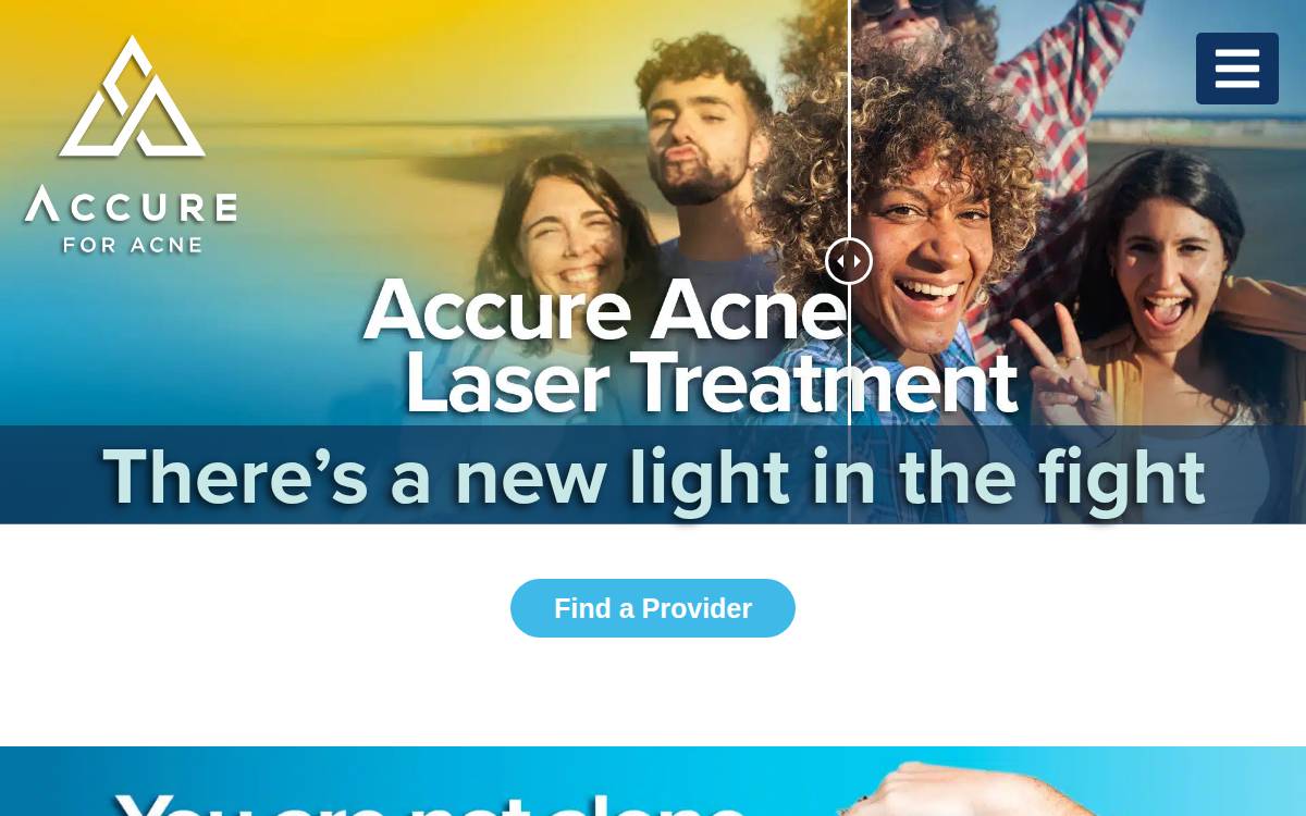 Accure Acne website preview