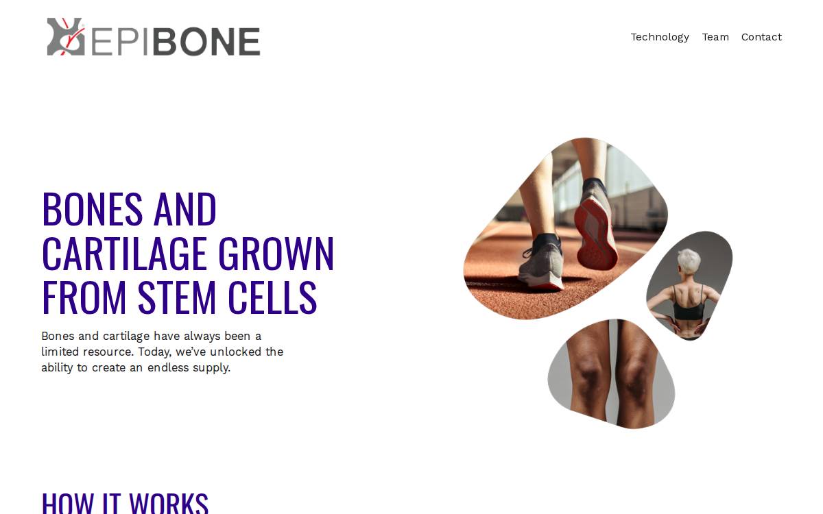 EpiBone website preview