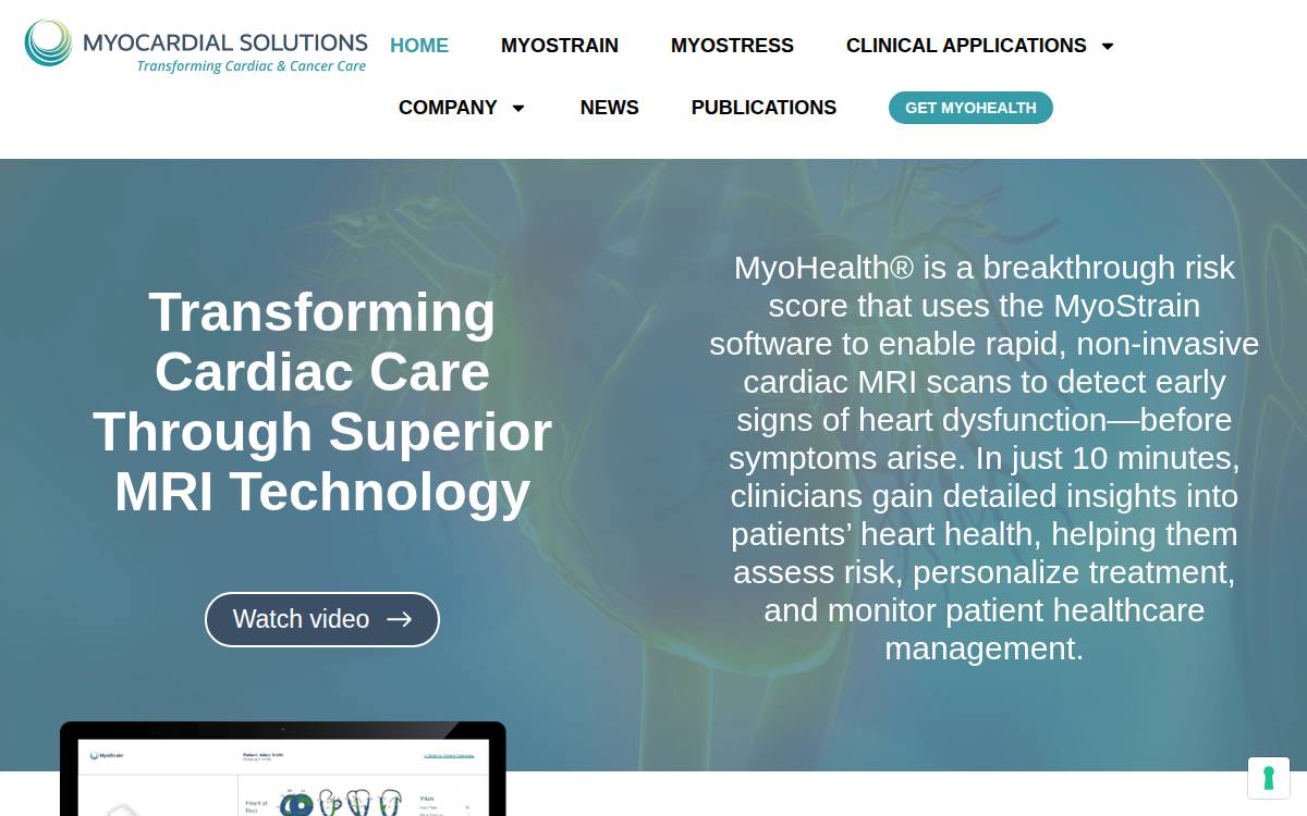 Myocardial Solutions website preview