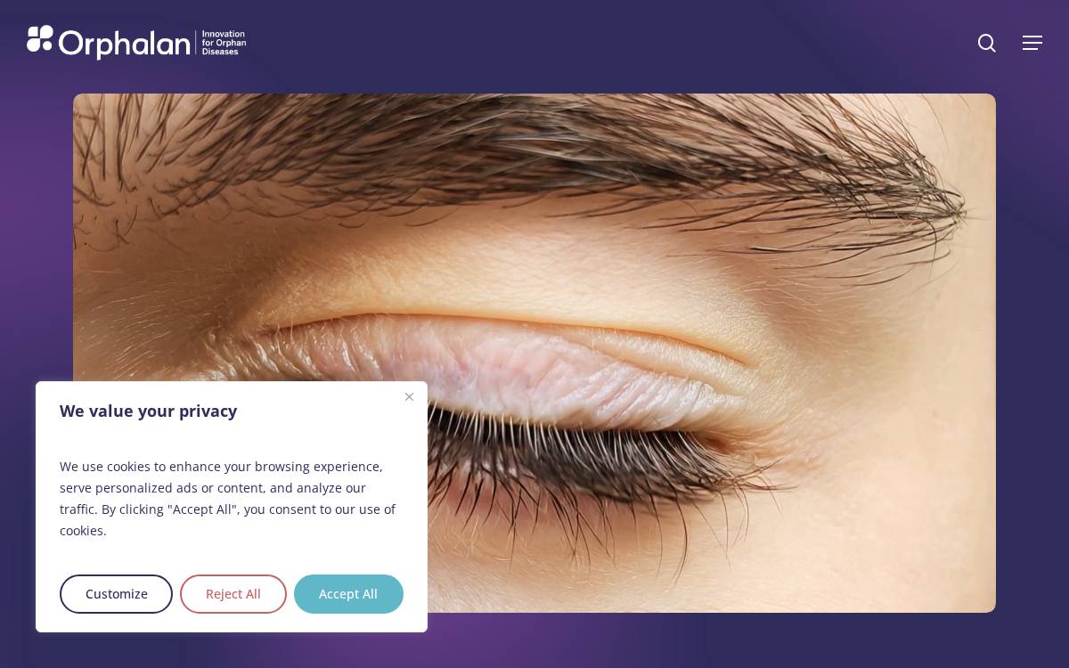 Orphalan website preview