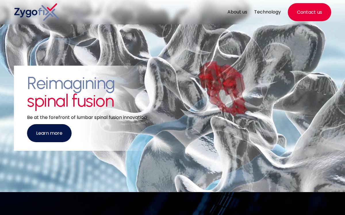 Zygofix website preview